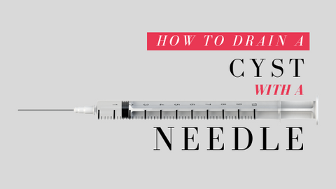how-to-drain-a-cyst-with-a-needle